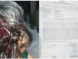 Teriakan Keadilan Dari Korban Pemukulan Atas Nama Makmur,Dan Anak Nya,APH Tutup Mata Sampai Hari Ini Pelaku Masi Berkeliaran