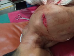 Korban  Penganiayaan Atas Nama Muhammad Amri Warga Pengkalan Dodek Kec. Medang Deras.