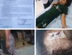 Korban Pemukulan Atas Nama Makmur Bersama Anak Nya Azzahra Yang Mana