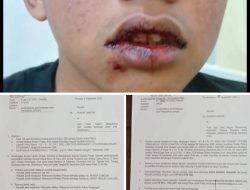 Keluarga dan Korban Penganiayaan Anak Dibawah Umur di Parapat Mengharap Kepastian Hukum, Pelaku Masih Bebas Berkeliaran